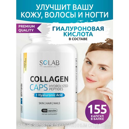   SOLAB          155   -     , -  