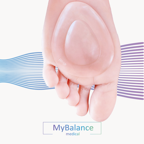     MyBalance,      , , , 2   -     , -  